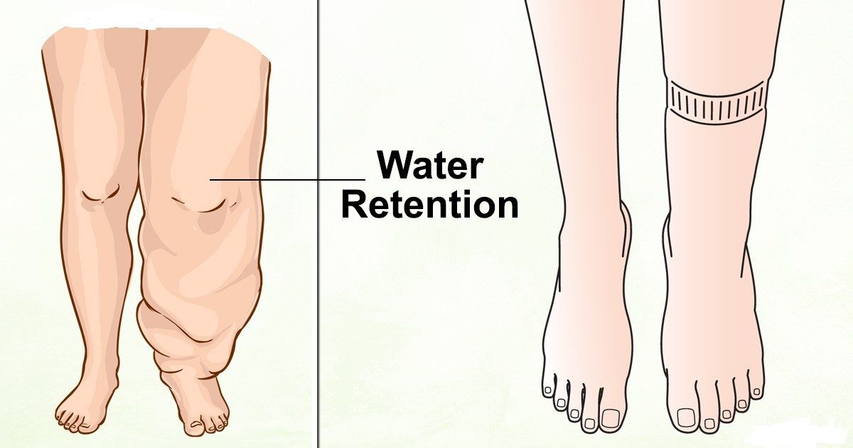 QU'EST-CE QUI PROVOQUE LA RÉTENTION D'EAU ET COMMENT L QU'EST-CE QUI PROVOQUE LA RÉTENTION D'EAU ET COMMENT L