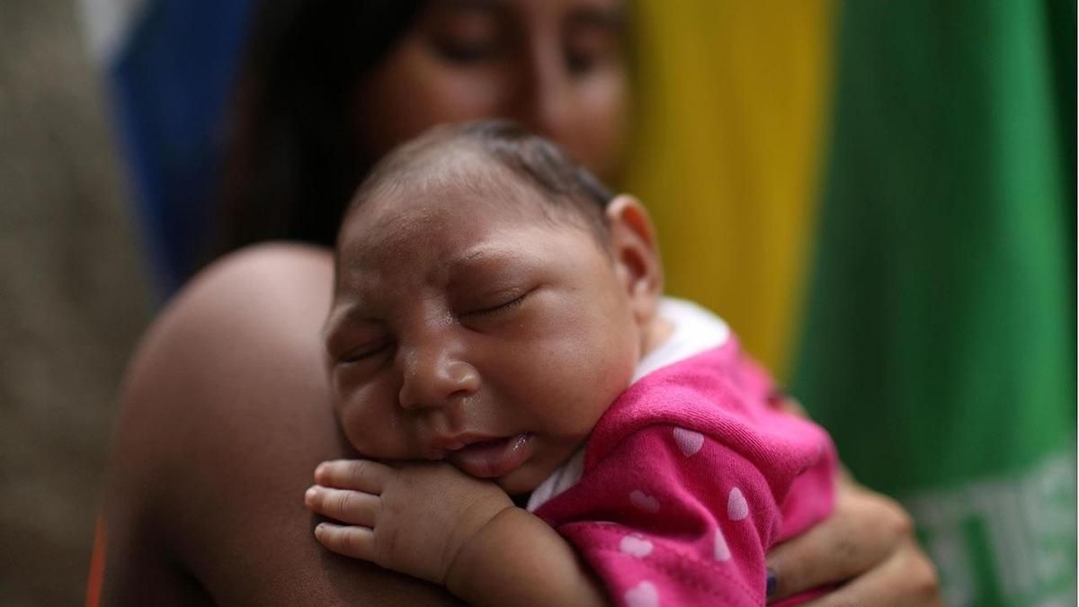 Ce bébé de Rio de Janeiro, au Brésil, est né avec une microcéphalie après que sa mère eut été infectée par le virus Zika au début de sa grossesse. (ANTONIO LACERDA / EFE / NEWSCOM)