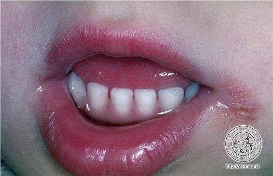 Un Jour Un Mot Faiscequilteplait Over Blog Com