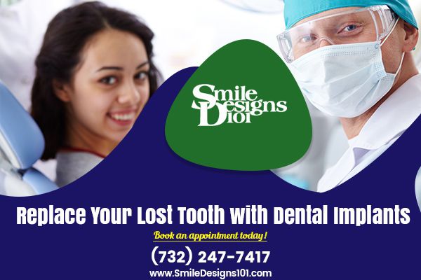 Low Cost Dental Implants