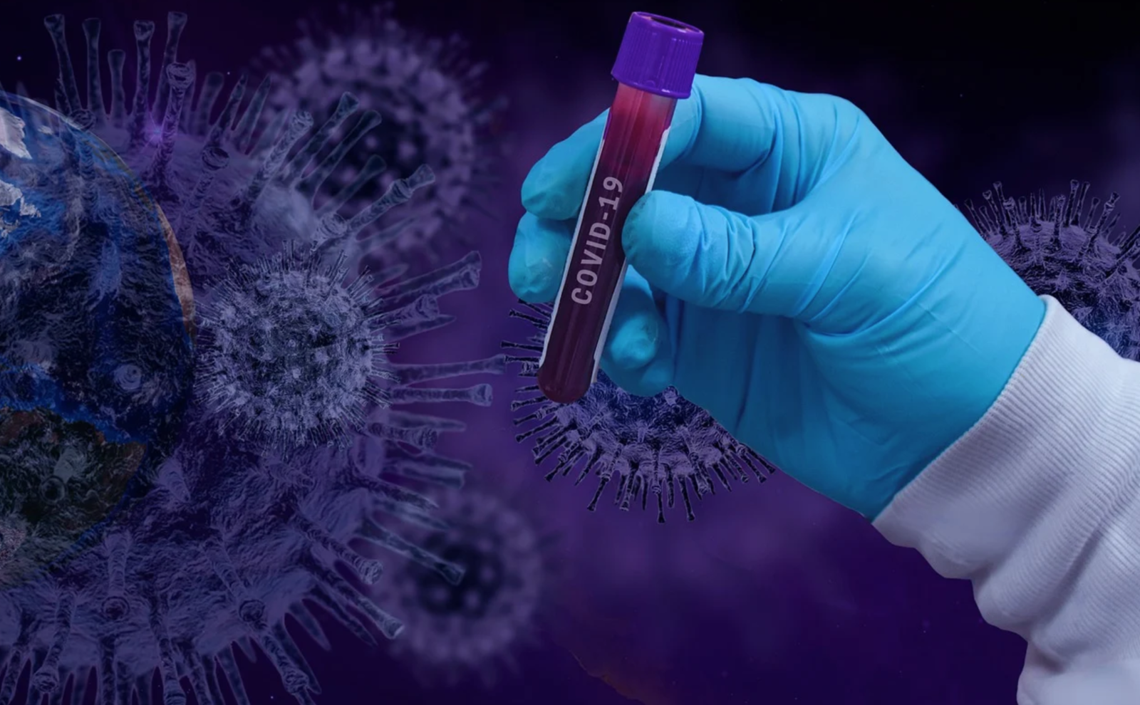 Covid-19 : 278 décès en Occitanie, dont 31 en Haute-Garonne