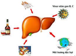 Nguyên nhân gây bệnh viêm gan siêu vi b là gì
