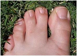 img_pied