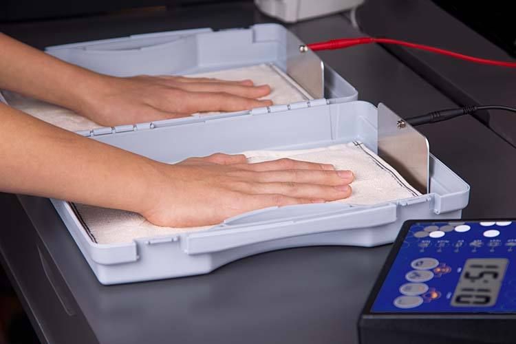 All about iontophoresis treatment Iontophoresis Advice Check Us