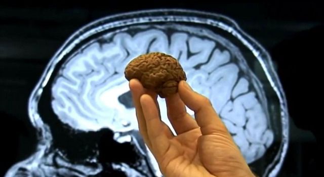 Mini cerveau