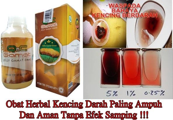 Obat Herbal Kencing Darah Paling Ampuh