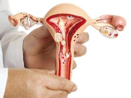 cara menghilangkan benjolan di vagina tanpa operasi