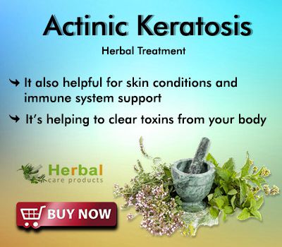 Herbal Treatment for Actinic Keratosis