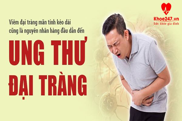Viêm đại tràng mãn tính nặng có thể gây ung thư đại tràng.