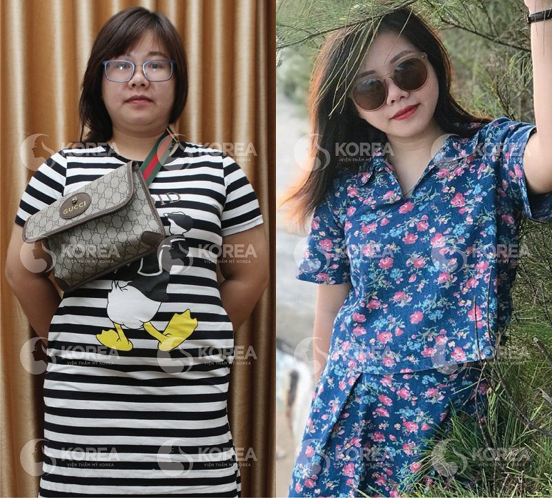 Chị Hà Xít trước và sau khi giảm béo thành công