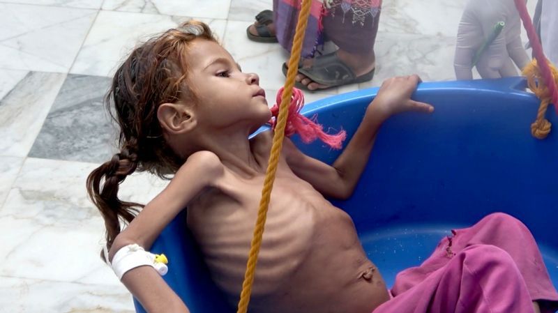 CCFY, Comité Contre la Famine au Yémen
