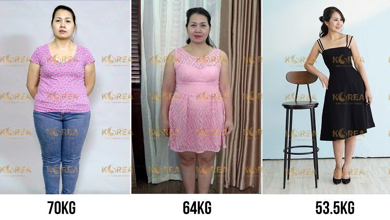 Chỉ với 1 liệu trình giảm béo Max Thin Lipo giúp chị Trang Chi loại bỏ thành công gần 20kg mỡ thừa