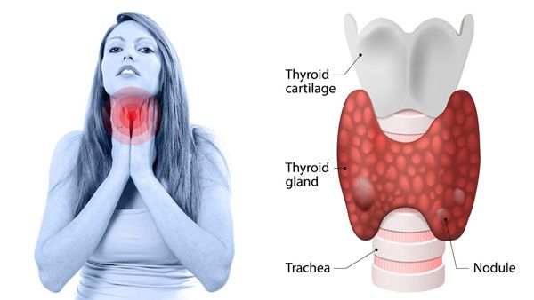 thyroid pills levels