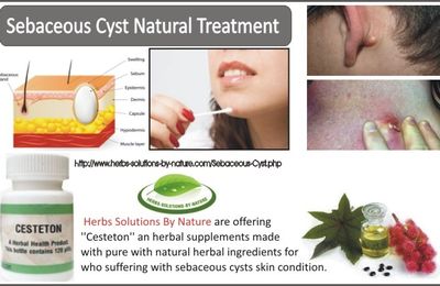 sebaceous cyst treatment vocal cord nodules and herbal treatment herbs solutions by nature sebaceous cyst treatment vocal cord nodules and herbal treatment herbs solutions by nature
