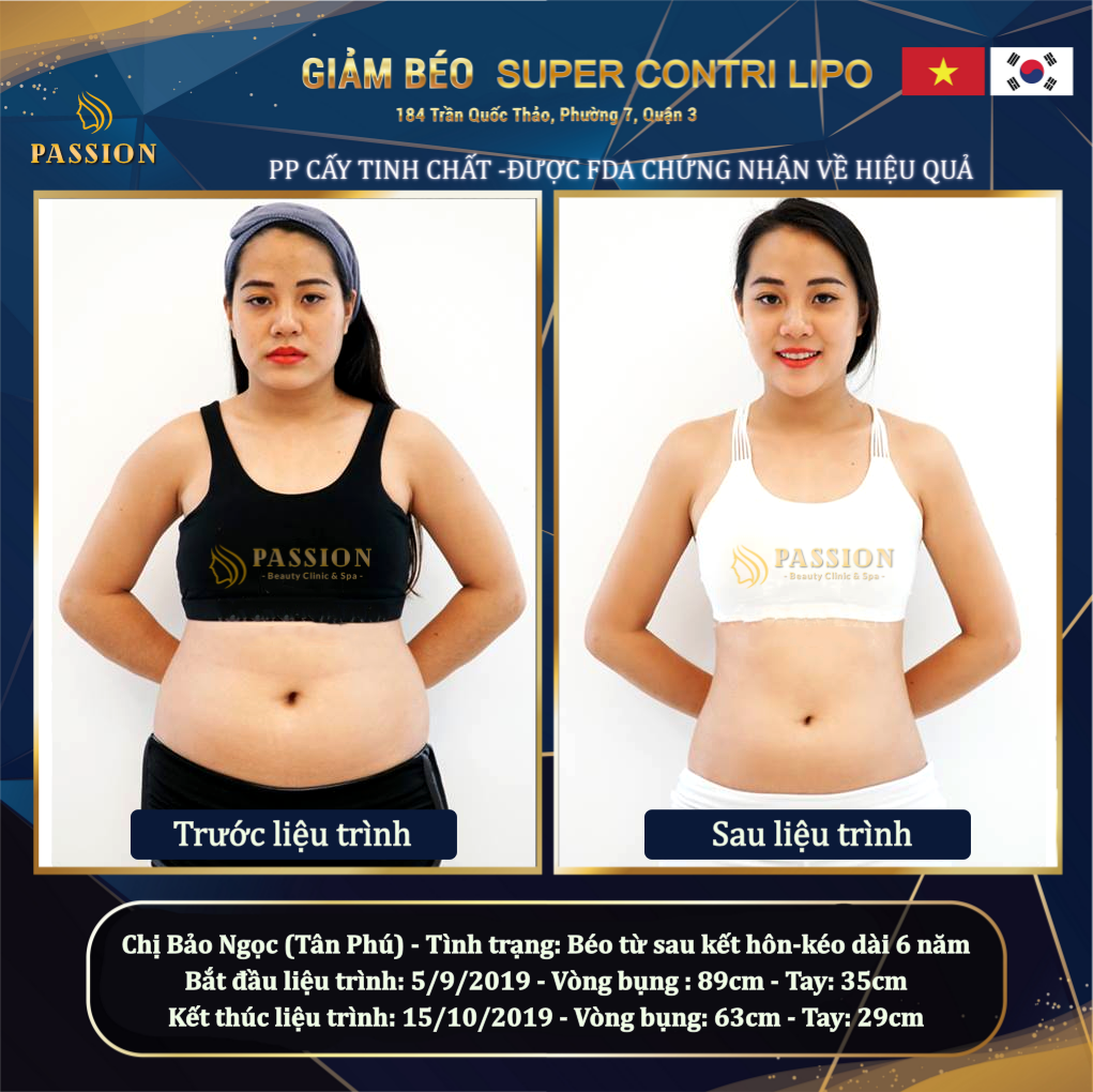Bảng Giá Dịch Vụ Tại Thẩm Mỹ Viện Passion 184 Trần Quốc Thảo 5 Thẩm Mỹ Viện Passion Giảm Béo Hiệu Quả