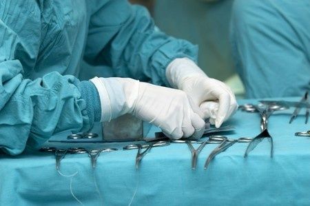 Porque duele el ombligo despues de una operacion de vesicula