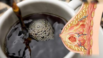 Aider à réduire votre risque de 13 cancers boire ce café tous les jours