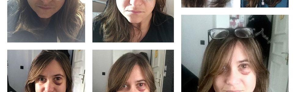 A s'en faire décoller la rétine...